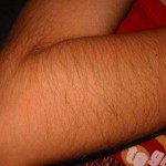 hairy arm 13