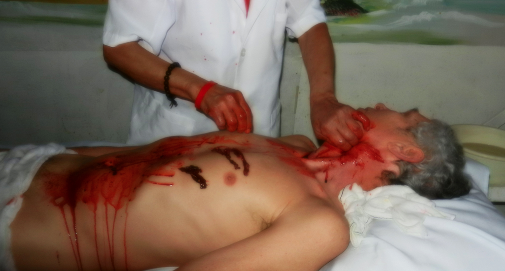 leacuri pentru fraieri