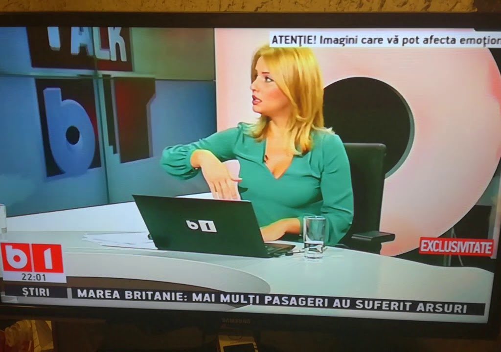 mirel palada l a tras de par pe