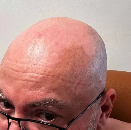 Mi-am schimbat aparatul de ras chelia